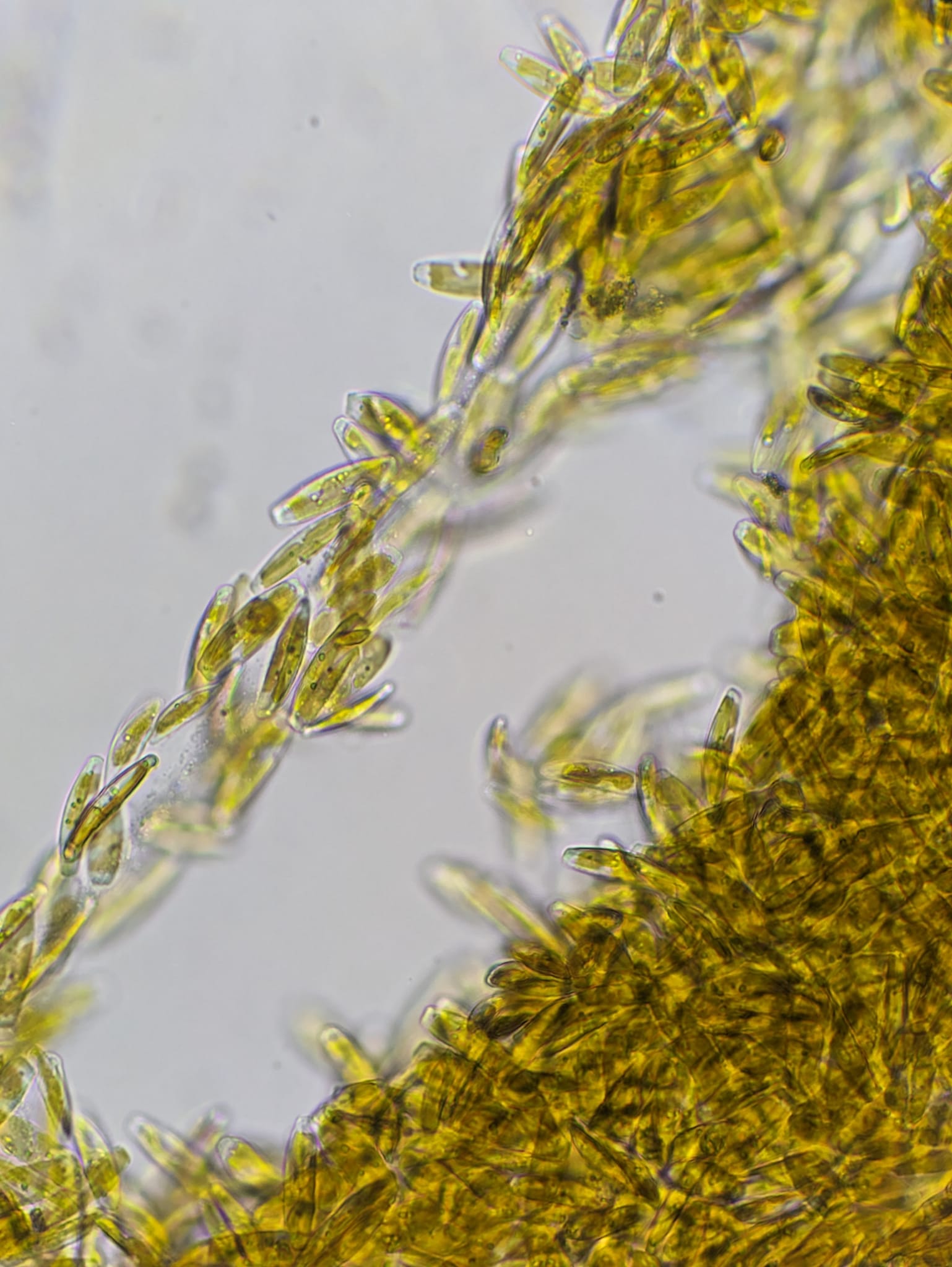 Diatoms displacing Dinos